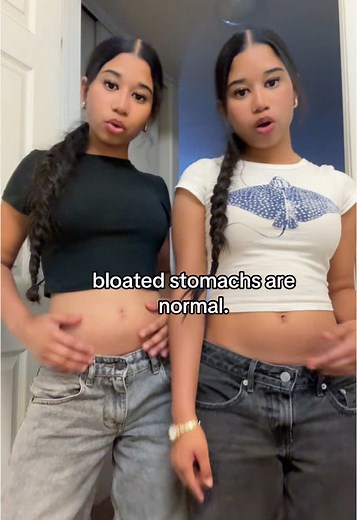 Understanding Normal Bloating in Twin Sisters