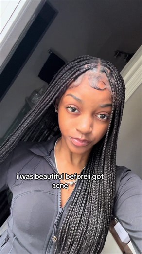 sexycrazygirl6256 (@sexycrazygirl6256)’s video of acne