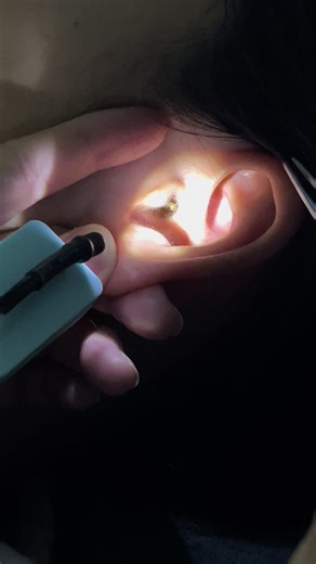 Promotion សំអាតត្រចៀក និងម៉ាស្សាមុខក្នុងភ្នំពេញ