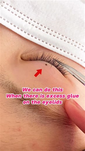 LymeeBeauty® Lashes Manufacturer on Instagram: "Here’s a quick solution if glue ends up on your client‘s eyelid! ✨🥰 Don’t stress! Just place your tweezers over the glue, let it dry, then gently lift it off. It’ll come right off without a hitch! 🙌 👇UNLOCK THE REFLECTION : 🛒 WEB : lymeebeauty.com 📱 APP : Download → CODE “ APP20 “ = 20 % OFF ! #lashglue #lymeebeauty #lashmagic #lashtips #lashlover"