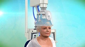 深圳瀚翔生物-Brainsway公司深度TMS之抑郁症治疗