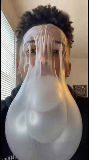 This Is Why You Don’t Play With Gum