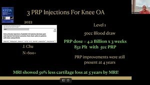 How to Properly Dose PRP for Rotator Cuff Tendons and Knee Arthritis
