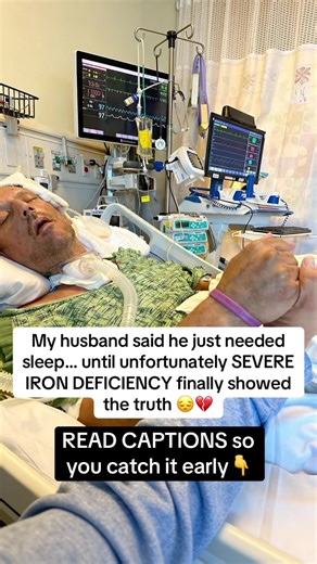 For months, he told himself it was just stress. Long days. Not enough sleep. But the fatigue kept getting worse. Simple things became exhausting. He felt dizzy, weak, and completely drained — even after resting. What we didn’t realize is that iron deficiency doesn’t always look dramatic at first. It often shows up as constant tiredness, shortness of breath, brain fog, pale skin, headaches, and feeling weak for no clear reason. By the time we finally checked his iron levels, the answer was obviou