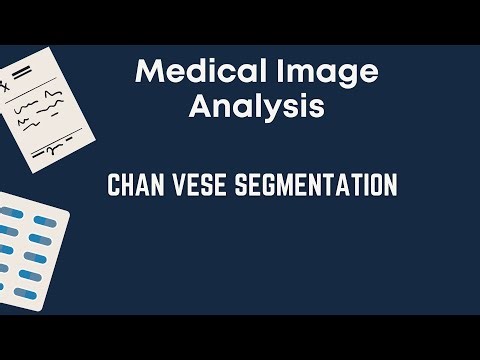 Chan Vese Segmentation