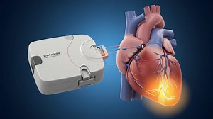 Innovative Heart Technology: A Dynamic Display of Cardiac Function with Interface System for Improved Health Monitoring and Management of Heart Conditions | Premium Stock Video Footage