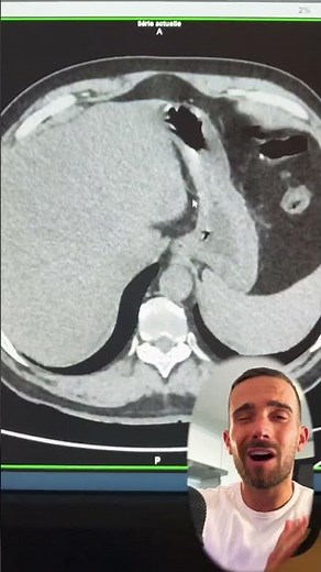 L’incroyable fonctionnement d’un scanner