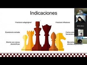 Extracción dental mediante colgajo