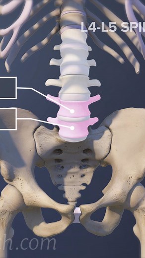 563K views · 2.9K reactions | Need to understand degenerative spondylolisthesis and how it causes back pain, leg pain, and nerve compression? 領 This video explains the symptoms, causes, and treatment options for spinal instability, including surgery and non-surgical care.  Perfect for anyone researching lower back pain, spinal stenosis, or slipped vertebra. ✅ | Spine-health | Facebook