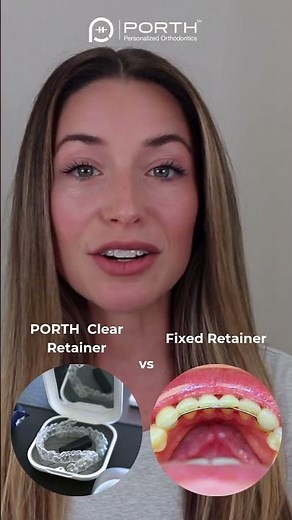 Clear Retainer vs Fixed Retainer #bracesjourney #dentaltreatment #orthodontist #retainers #retainer