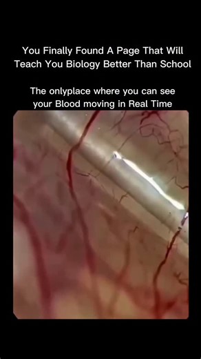 Explaining Biology on Instagram: "The only place where you can see your blood moving in real time is your own eye 👁️🩸 When light enters your eye, it passes through tiny transparent blood vessels in the retina. If you look at a bright blue sky or a white screen, you might notice tiny moving dots or squiggly lines — that’s your white blood cells flowing through capillaries. These vessels are so thin and clear that blood flow becomes visible without any microscope. It’s called the Blue Field Ento
