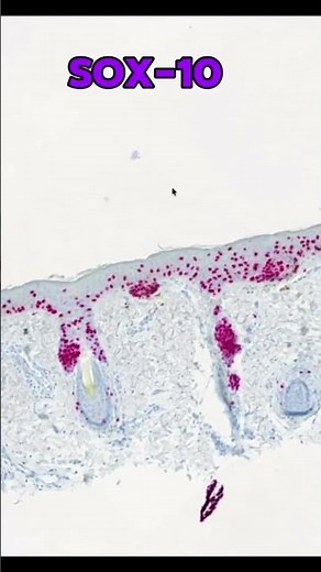 Here is the pathology for this case