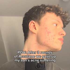 5.9K views · 8.5K reactions | If your TEEN has ACNE you must get...