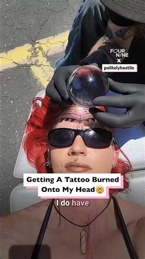 Burning A Tattoo Onto My Forehead 🌞 🤯