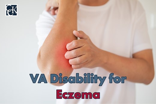 VA Disability for Eczema | CCK Law