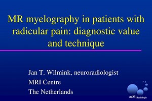 MR myelography in patients with radicular pain: diagnostic value and technique - SlideServe