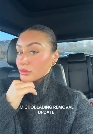 Microblading Removal Update: My Life Changed