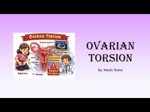 Ovarian torsion - definition, pathophysiology, symptoms, investigations, treatment