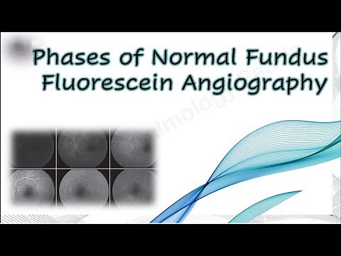 Phases of Normal Fundus Fluorescein Angiography