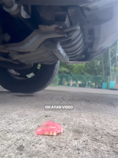 Durable ISRA Dentures: Walang Crack, Walang Gas-gas!