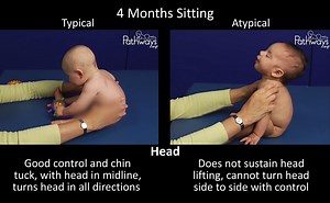 83K views · 734 reactions | Does your 4 month old baby have good control of their head while in midline in the sitting position? Use this typical and atypical motor development video to help you recognize early motor delays. Remember to adjust for prematurity. If you have concerns, talk to your healthcare provider. ➡️ View full video: https://pathways.org/watch/4-month-old-typical-and-atypical-motor-development/ | Pathways.org | Facebook