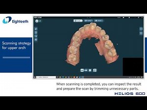 Eighteeth Intraoral Scanner Helios 600 Full Arch Scan Strategy Eighteeth Digital Academy