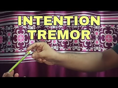 Intention Tremor | Simplified ✔