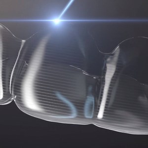 How do we go about straightening teeth? For us, the answer is clear. Discover how our Invisalign® clear aligners have transformed more than 5 million smiles worldwide po.st/hpukfb | Invisalign UK & Ireland