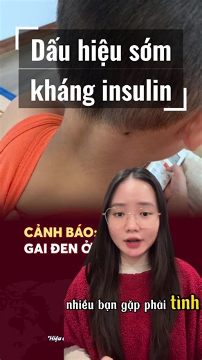 Dấu Hiệu Sớm Kháng Insulin Cần Chú Ý