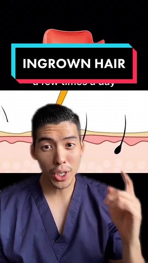 Understanding and Treating Ingrown Hairs | Educational Video