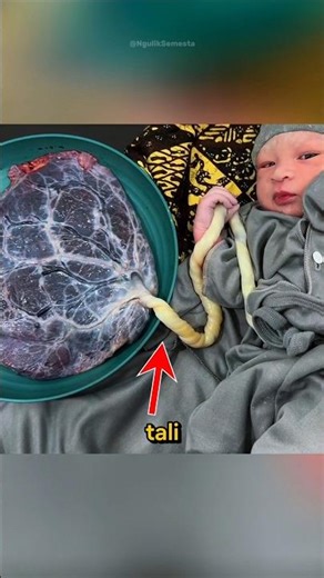 Why Isn't the Umbilical Cord Cut?