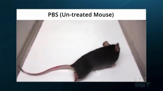 CTV National News Inside Quantum BioPharma’s $700M Spoofing Case and MS Research Efforts Live On-Air recording by CTV News (@CTVNews) W5 investigative journalist Jon Woodward (@ctv_jon) exploring whether a Canadian company’s Multiple Sclerosis research was nearly derailed by alleged market manipulation. https://youtu.be/-RX3-af3NGc #MS #Multiplesclerosis #Spoofing #NationalNews #Canada #CTVNews #Biotech $QNTM #QNTM #RT #Onpoli #CNDPoli #USA #Baystreet #Wallstreet | Quantum BioPharma
