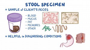 Video: Gastrointestinal: Collecting a stool specimen (for nursing assistant training) - Video Explanation! | Osmosis