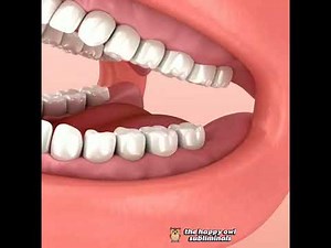 Molar and premolar teeth regrowth subliminal.(Sleep version)