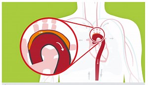 Your Aorta: The Pulse of Life