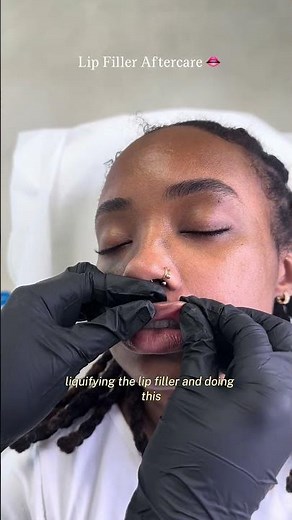 LIP FILLER AFTERCARE #lipfillers # #facialbalancing #skincare #facialist #beauty