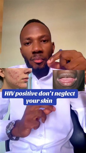 HIV Skin Care: Treating Red Lips, Rashes & Itchy Skin