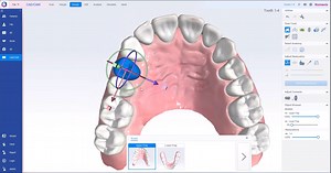 How to – Design a restoration using teeth library in the CAD/CAM module of Planmeca Romexis