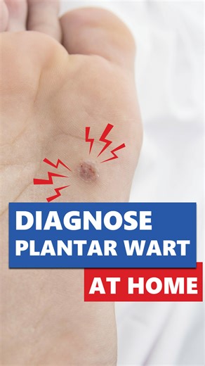 禮 That bump on your foot? It might not be just a callus…  If you’ve...