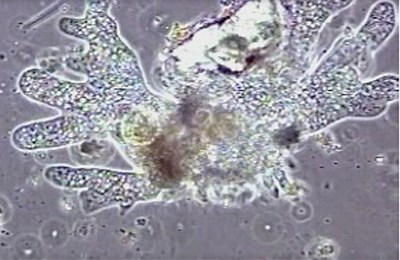Galleries | Amoeba (Protozoan) Videos