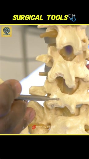 Why are surgical tools used in operations? 🦷.... 😱#shorts