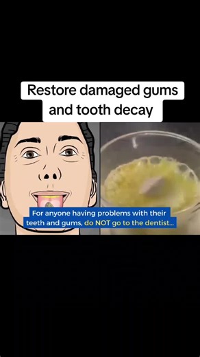 Restore Teeth and Gums Naturally for a Healthier Smile