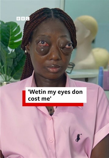 Young Nigerian Woman's Rhinoscleroma Journey