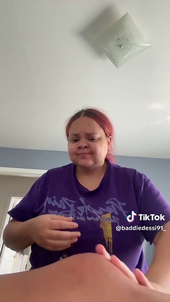 Understanding Knock Knees: Causes and Remedies