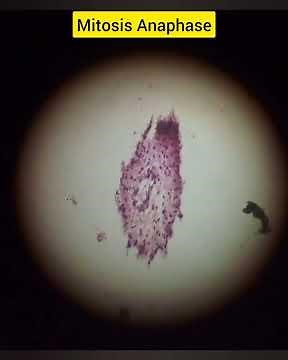 Stages of Mitosis under microscope 🔬