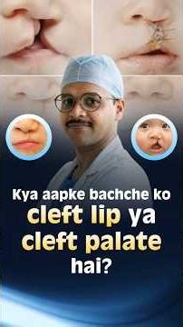 Understanding Cleft Lip and Cleft Palate | Dr Vinay Baretha