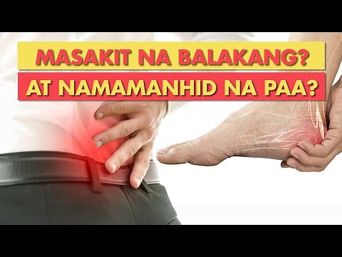 [Q & A] PANANAKIT NG BALAKANG, PAMAMANHID NG PAA AT IBA PANG MEDICAL QUESTIONS