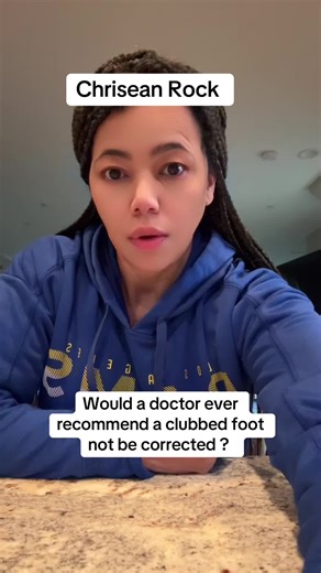 Do doctors always recommend that clubbed feet are corrected ? #chriseanrock #clubbedfeet #specialneedsmom