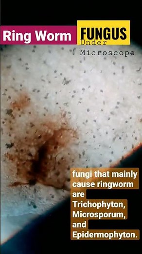 Ringworm Fungus🦠.Under Microscope