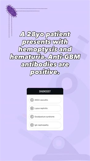 med's go on Instagram: "Goodpasture syndrome is caused by anti-GBM antibodies directed against type IV collagen in the basement membranes of both glomeruli and alveoli. Clinically, it presents with pulmonary hemorrhage (hemoptysis) and rapidly progressive glomerulonephritis, often with crescent formation on biopsy. Immunofluorescence shows a linear IgG pattern along the GBM, which distinguishes it from immune complex diseases that show granular patterns. It is a type II hypersensitivity reaction